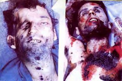 The Milici Massacre, south of Srebrenica. Bosnian Muslim troops executed Bosnian Serbs and mutilated their bodies. On left, Ljubomir Jurosevic had his right eye cut out by Bosnian Muslim soldiers and his neck and chest showed signs of knife wounds.On right, the mutilated body of Bosnian Serb Dimitrije Alempic from Rogosije, who was executed by Bosnian Muslim soldiers. His body was mutilated and burned.