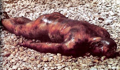 The body of a Bosnian Serb from Sarajevo, who was killed, mutilated, and burned. His body was thrown in the Miljacka river by Bosnian Muslim forces.