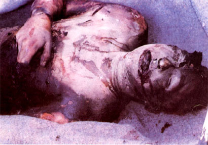 The mutilated body of Velo Majstorovic, who was tortured, killed, circumcized, and burned alive by Bosnian Muslim forces in Milici in eastern Bosnia, southwest of Srebrenica.