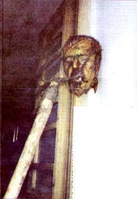The decapitated head of Bosnian Serb farmer Pero Makic, who was executed by Bosnian Muslim/Croat forces in the northeastern Bosnian city of Brcko on June 22, 1992. His head was placed on a pitch-fork and a cigarette was placed in his mouth. One of the forks of the pitch-fork was stabbed in his eye. This is a photo that was censored and suppressed in the West and the US.