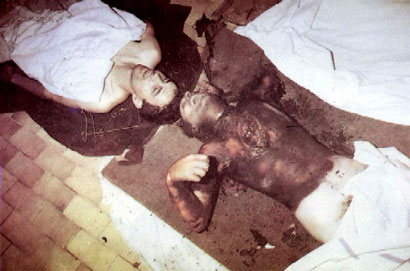 The bodies of two Bosnian Serbs in eastern Bosnia. On the right, a charred body of Zdravo Eric, who was killed and his body burned. Before burning him, Muslims took out the heart of this Christian as a sign of Islamic piety.