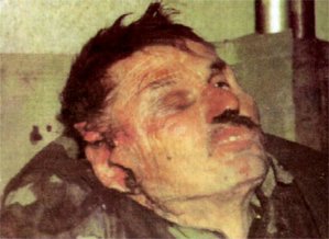 Sarajevo: The body of a Bosnian Serb. Bosnian Muslim forces murdered and mutilated him by smashing his skull open.