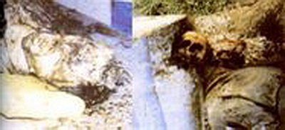 First massacre in Bosnia: March 26, 1992, Croat and Bosnian Muslim forces executed, mutilated, and beheaded 20 Bosnian Serb civilians in Sijekovac near Bosanski Brod. An 85 year Bosnian Serb was executed and then burned inside his house. The decapitated and mutilated corpses of Bosnian Serbs murdered in northern Bosnia near Brod.