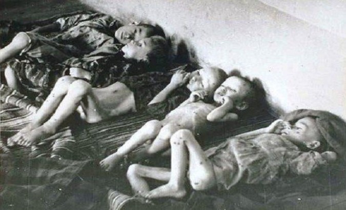 emaciated-and-sick-children-suffering-at-jasenovac1